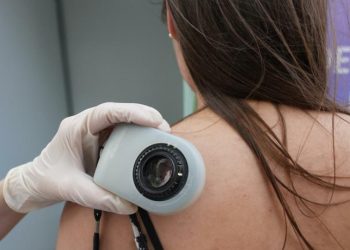 Na pregledu kože 181 građanin