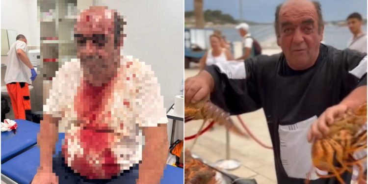 Slobodna Dalmacija – Ovo je zadnji video koji je hvarski kuhar Mijo snimio ispred ‘Garifula’ prije brutalnog napada. Svi šalju poruke podrške