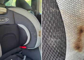 Auto Klub – ‘Dijete mi je skoro izgorjelo u autosjedalici!’ Šokirana majka proživjela noćnu moru svakog roditelja