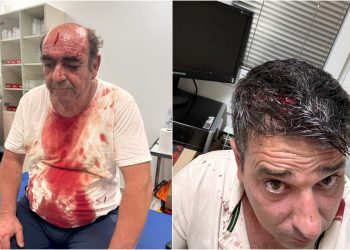 ‘OVO JE POKUŠAJ UBOJSTVA’ Napadnuti vlasnik restorana o brutalnom obračunu: Razlog nije glasna glazba… | NACIONAL.HR