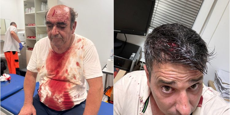 ‘OVO JE POKUŠAJ UBOJSTVA’ Napadnuti vlasnik restorana o brutalnom obračunu: Razlog nije glasna glazba… | NACIONAL.HR