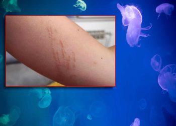 Danima nam dica iz mora izlaze opečena!