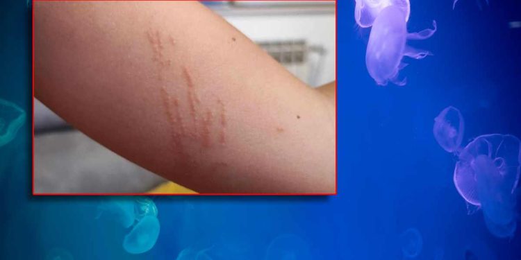 Danima nam dica iz mora izlaze opečena!