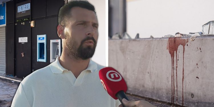 Ivošević o nesreći s puknućem stakla: Pijana mladost koja je pokušavala ili nije mogla ući u klub zbog svoje dobi