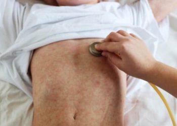 LIJEČNICI POZIVAJU NA IMUNIZACIJU Preminuo 18-godišnjak iz Zenice od morbila