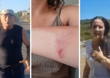 Nagrađivana novinarka fizički napadnuta u vlastitoj kući kod Zadra