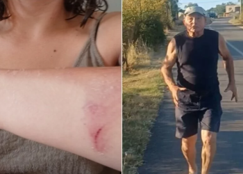 Otac i sestra poznatog dalmatinskog HDZ-ovca napali novinarku: “Upala mi je u kuću i čupala me. Morala sam je ugristi do krvi”