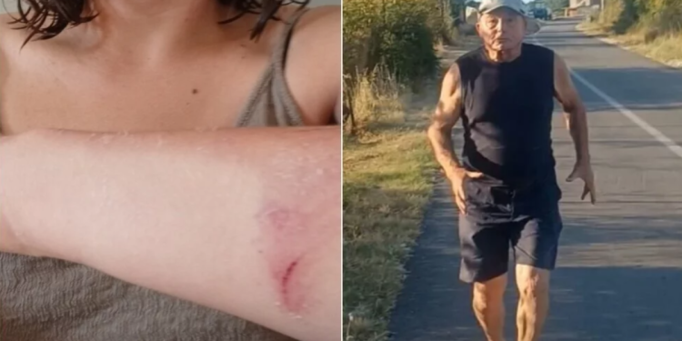 Otac i sestra poznatog dalmatinskog HDZ-ovca napali novinarku: “Upala mi je u kuću i čupala me. Morala sam je ugristi do krvi”