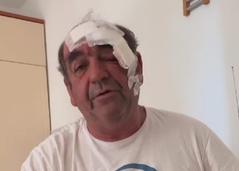 Ozlijeđeni kuhar Mijo nakon napada zahvalio se svima na potpori