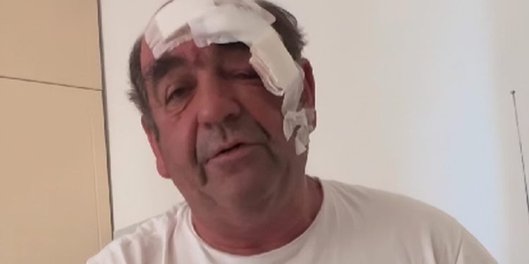 Ozlijeđeni kuhar Mijo nakon napada zahvalio se svima na potpori