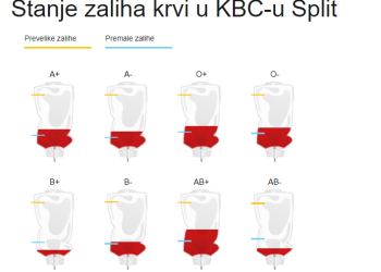 Slobodna Dalmacija – Ovo su zalihe krvi u KBC-u Split: nedostaje svih krvnih grupa, posebno je kritično s AB-. Apeli stižu sa svih strana…