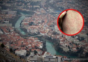 EPIDEMIJA OSPICA STIGLA U MOSTAR Iz Doma zdravlja otkrili zdravstveno stanje zaražene djece