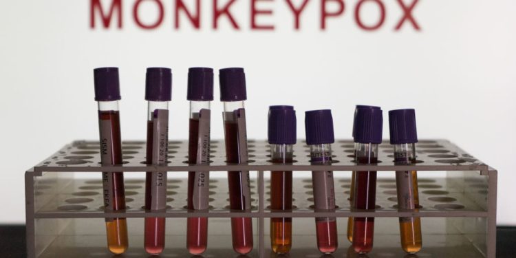 Kina će provjeravati dolaske za mpox — RT World News