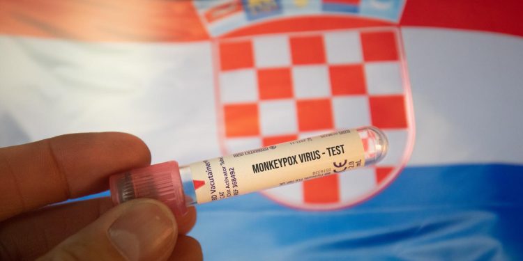 NOVA EPIDEMIJA! HZJZ objavio izvješće o mpoxu: Novi soj izazvao je globalnu zabrinutost… | NACIONAL.HR