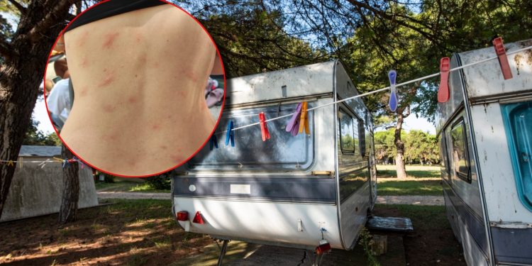 Turiste u Hrvatskoj zatekla neugodna pojava, pokazali ugrize po tijelu: ‘Tko može prepoznati ovo?’