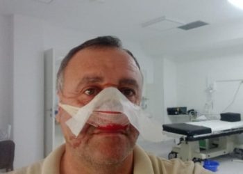 FIZIČKI NAPAD Pretučen Marko Novaković