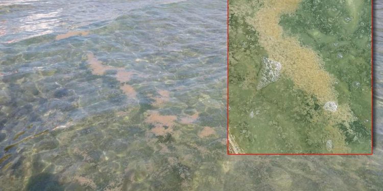 Još prošle godine pukla cijev od kanalizacije, turisti dobili osip i završili u bolnici