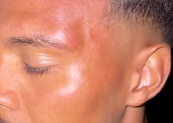 Nürnberg, igrač napadnut jer je nosio dres Bayern Münchena