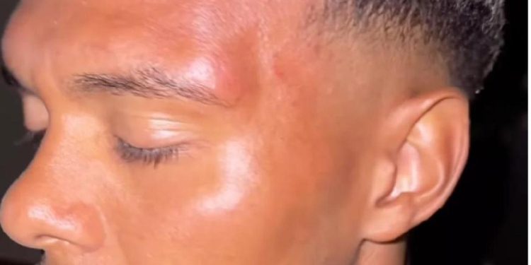 Nürnberg, igrač napadnut jer je nosio dres Bayern Münchena