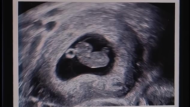 Pred kraj videa moglo se vidjeti kako Hailie poklanja ocu plavo-žuti nogometni dres na kojem je na leđima pisalo 'Djed', kao i ultrazvučnu sliku svoje bebe