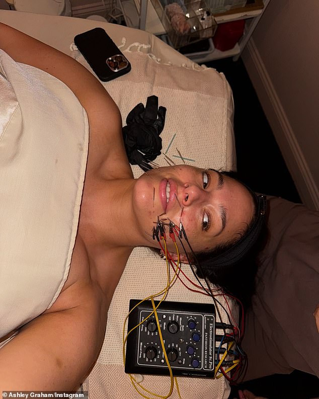 IMG model veće veličine - koja 30. listopada puni 37 godina - angažirala je osnivačicu Lanshina Sandru Lanshin Chiu da koristi njezine TCM/Gua Sha tehnike kao alternativu Botoxu