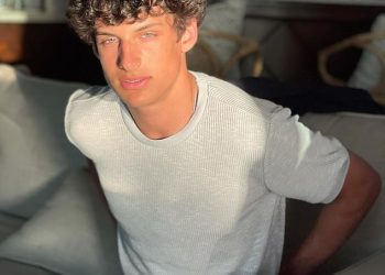 Zvijezda MILF Manor Joey Burford treba ‘operaciju rekonstrukcije lica’ nakon razorne nesreće skutera