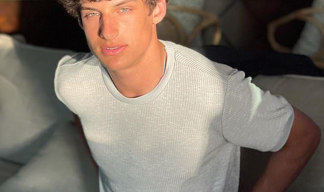 Zvijezda MILF Manor Joey Burford treba ‘operaciju rekonstrukcije lica’ nakon razorne nesreće skutera