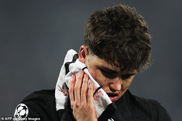 Pau Cubarsi suffered a nasty facial injury during Barcelona's 5-2 win over Crvena zvezda