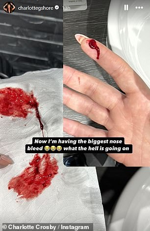 Njezina posljednja priča na Instagramu prije racije bila je kako se opušta u krevetu s maskom na licu nakon što je pretrpjela nesnosne bolove u leđima i krvarenje iz nosa ranije tog dana