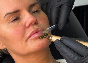 Kerry Katona uzvraća udarac okrutnim trolovima nakon što su osudili njezino nedavno uređivanje usana i usporedili je s ‘patkom’