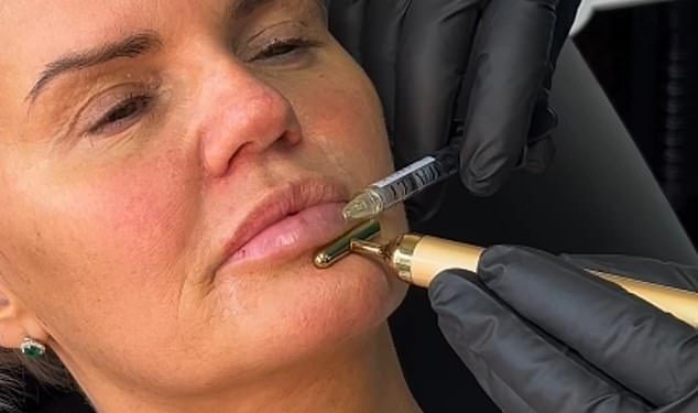 Kerry Katona uzvraća udarac okrutnim trolovima nakon što su osudili njezino nedavno uređivanje usana i usporedili je s ‘patkom’