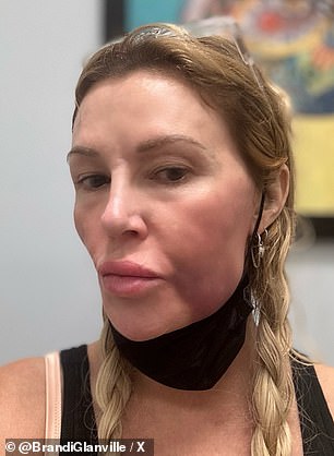 Bivša zvijezda Real Housewives of Beverly Hills pokazuje šokantne promjene na svom licu