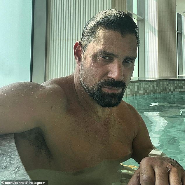 Manu Bennett otkrio je kako mu je nesreća s horor dune buggyjem 'utrobila' ruku i zbog čega je morao na više operacija i šavova, mjesecima nakon nesreće