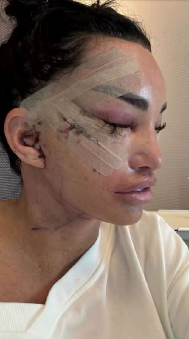 Legenda je također ispričala kako, iako se tek nedavno podvrgnula faceliftingu, uskoro ide na još jedan kako bi joj uši 'izgledale normalno' (Katie je viđena neposredno nakon operacije)