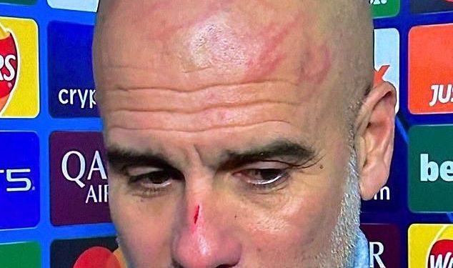 Otkriveno: kako je Pep Guardiola dobio ONAK rez na nosu nakon što je njegov Man City odbacio prednost od tri pogotka protiv Feyenoorda – dok Guillem Balague daje uvid u menadžerovu ‘sumnju u sebe’ i ‘nervozu’