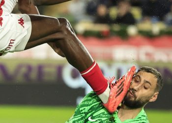 UŽAS U MONACU Pogledajte kako izgleda golman PSG-a nakon brutalnog udarca i deset šavova! | NACIONAL.HR