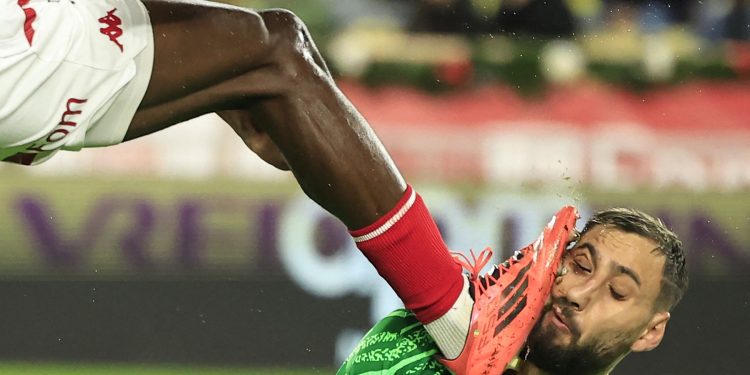 UŽAS U MONACU Pogledajte kako izgleda golman PSG-a nakon brutalnog udarca i deset šavova! | NACIONAL.HR