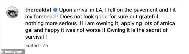 Diane von Fürstenberg, 78, dala je obožavateljima šok kad je objavila fotografiju u kojoj je istaknula gadno crno oko koje je nedavno stekla