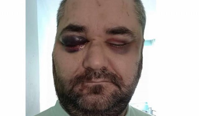 NASILNIČKO PONAŠANJE Osuđeni napadači koji su teško pretukli konjičkog novinara Isu Džinu