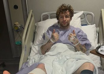 Pop zvijezda otkriva da je hospitaliziran s gadnim ozljedama nogu dok predviđa dugi ‘put do oporavka’