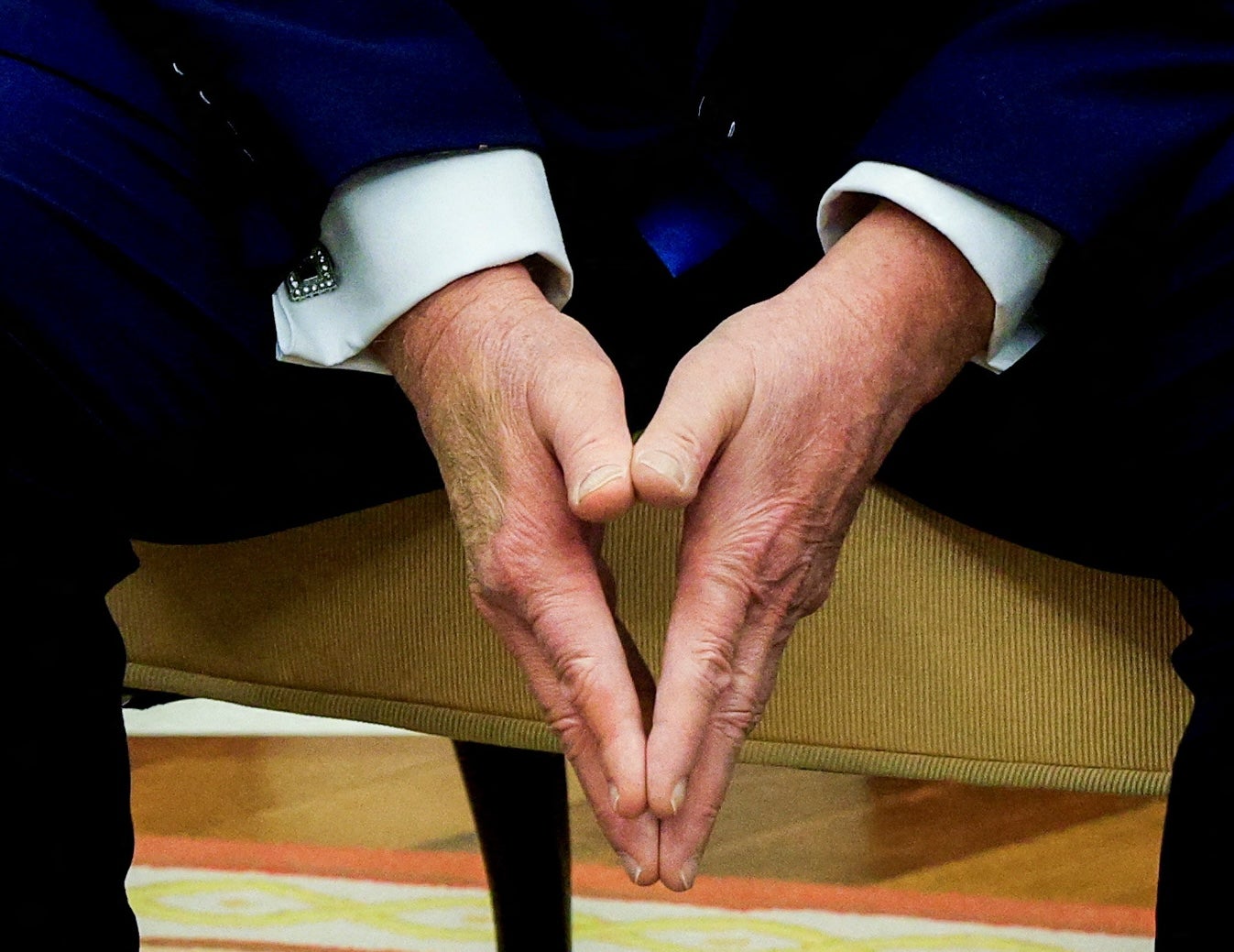 Korisnici društvenih medija nagađaju što je izazvalo modrice na rukama predsjednika Donalda Trumpa, jer Bijela kuća inzistira na tome da je samo ručno stisnuo