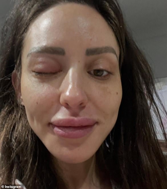 Dolazi nakon što je Lizzie otkrila nedavno iscrpljujuće zdravstveno stanje tijekom svoje druge trudnoće