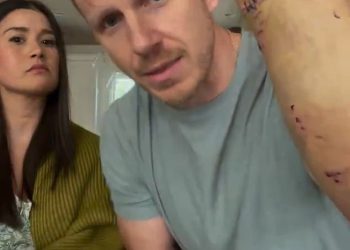 Bachelor Star gotovo ubijen od vlastitog obiteljskog psa nakon dva brutalna napada u 12 sati