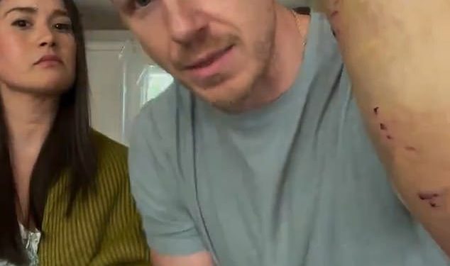 Bachelor Star gotovo ubijen od vlastitog obiteljskog psa nakon dva brutalna napada u 12 sati