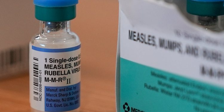 Druga potencijalna smrt iz epidemije ospica nakon necijepljenog stanovnika Novog Meksika umire