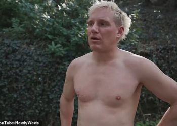 Jamie Laing tretira obožavatelje na još jednu sliku stopala dok dijeli zdravstveno ažuriranje o svojim ozljedama nakon Brutalnog ultra maratonskog izazova na 150 milja za komično olakšanje