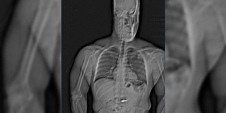 Thief se pozirao kao rep Orlando Magic Player kako bi ukrao nakit Tiffany vrijedan 750 tisuća dolara – a zatim ga pojeo, kažu policija