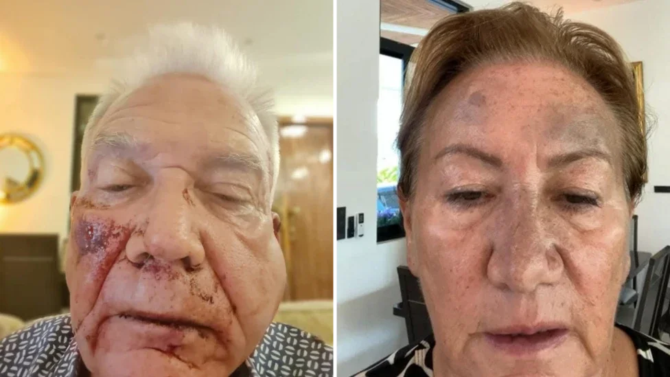 Par je kasnije pozvan u policijsku stanicu i rekao da će im biti optuženi