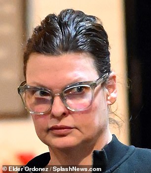 Postupak je dizajniran za smanjenje njenih masnih stanica, ali umjesto toga, natjerao ih je da se povećaju - na slici 2022. godine