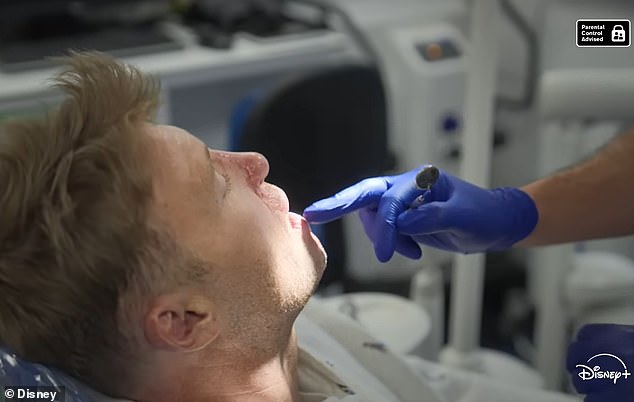 Bivša zvijezda kriketa u Engleskoj pretvorila je TV voditelj izgubila značajan dio usana